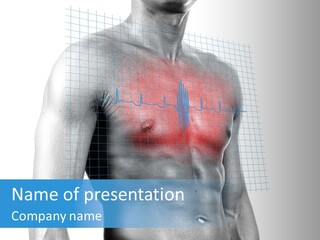 Emergency Coronary Torture PowerPoint Template