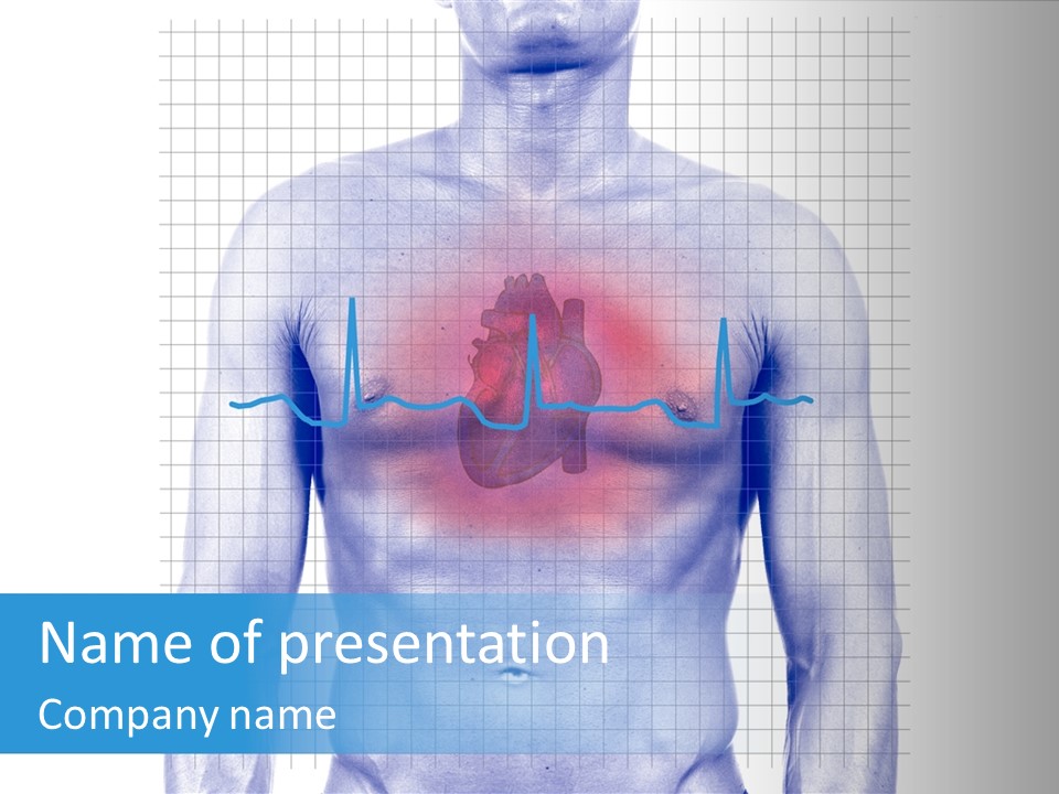 Infarction Emergency Illness PowerPoint Template