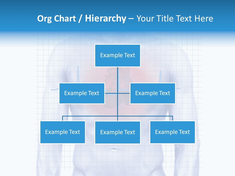 Infarction Emergency Illness PowerPoint Template