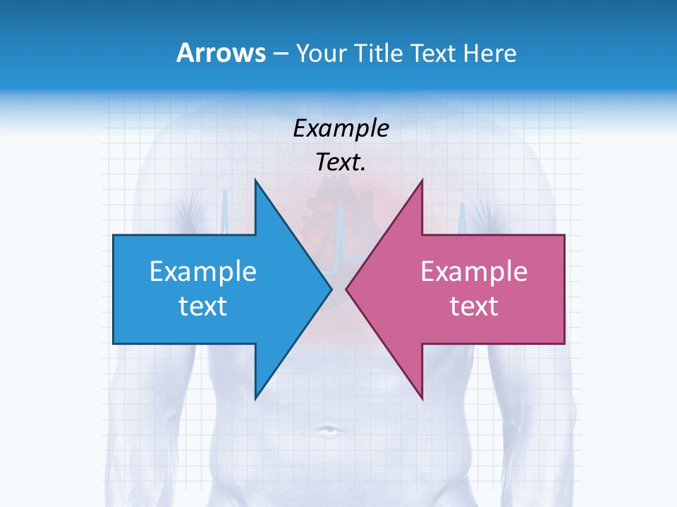 Infarction Emergency Illness PowerPoint Template