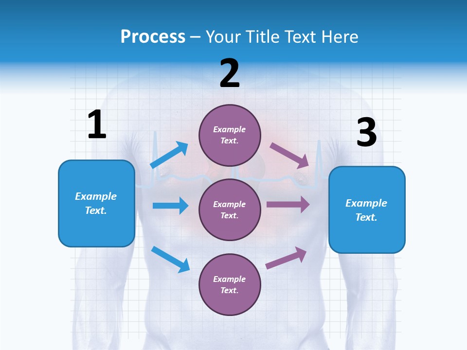 Infarction Emergency Illness PowerPoint Template