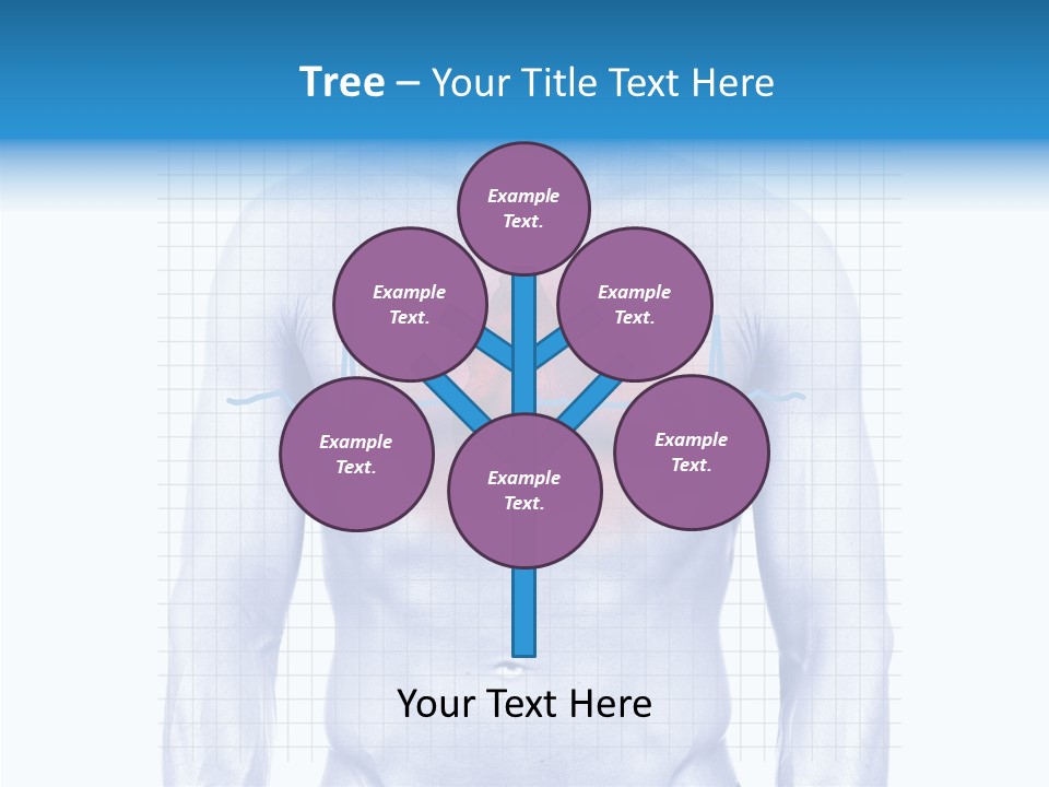 Infarction Emergency Illness PowerPoint Template