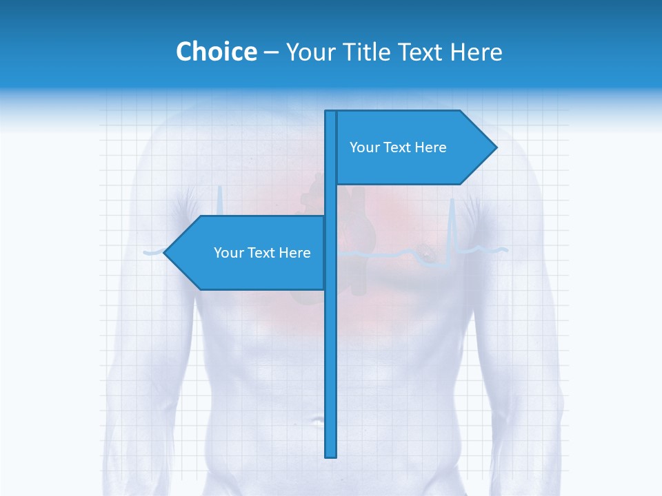Infarction Emergency Illness PowerPoint Template