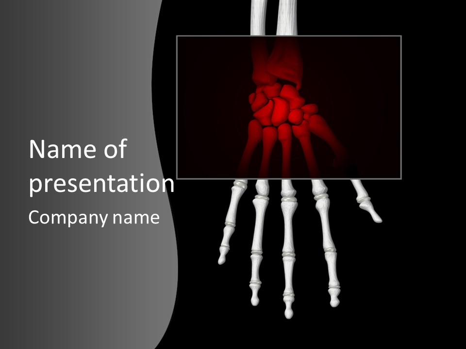 Female Hand Broken PowerPoint Template