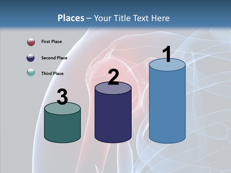 Inflammation Arthritis Pain PowerPoint Template