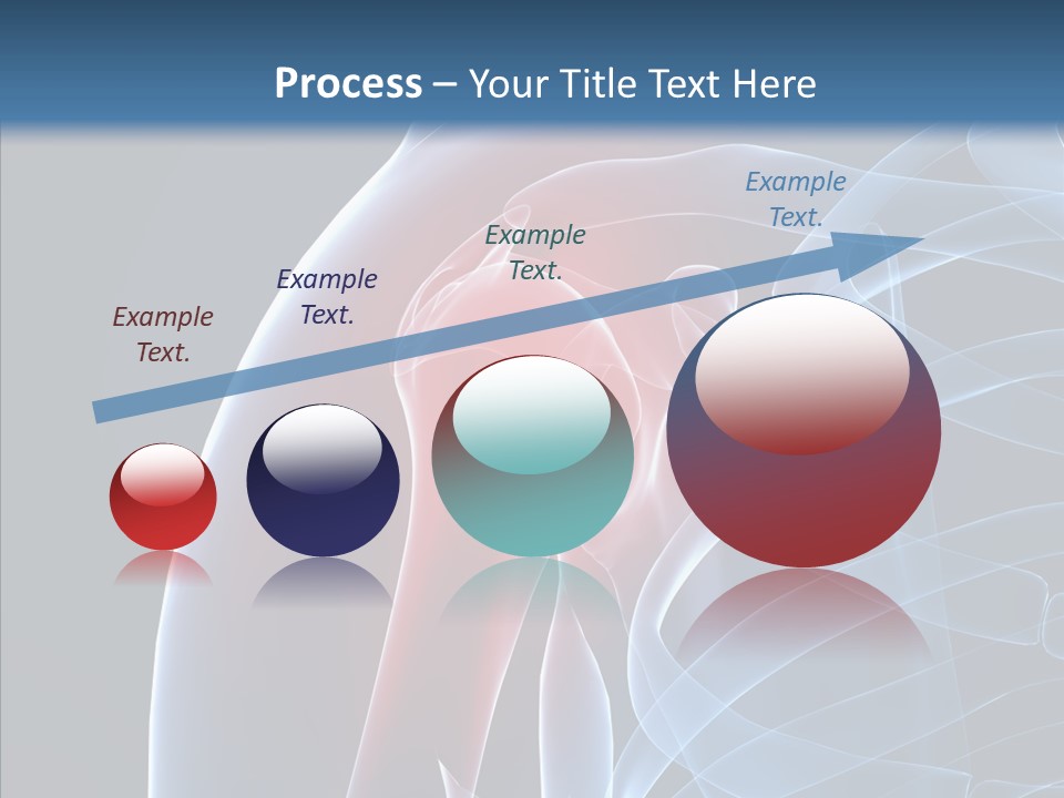 Inflammation Arthritis Pain PowerPoint Template