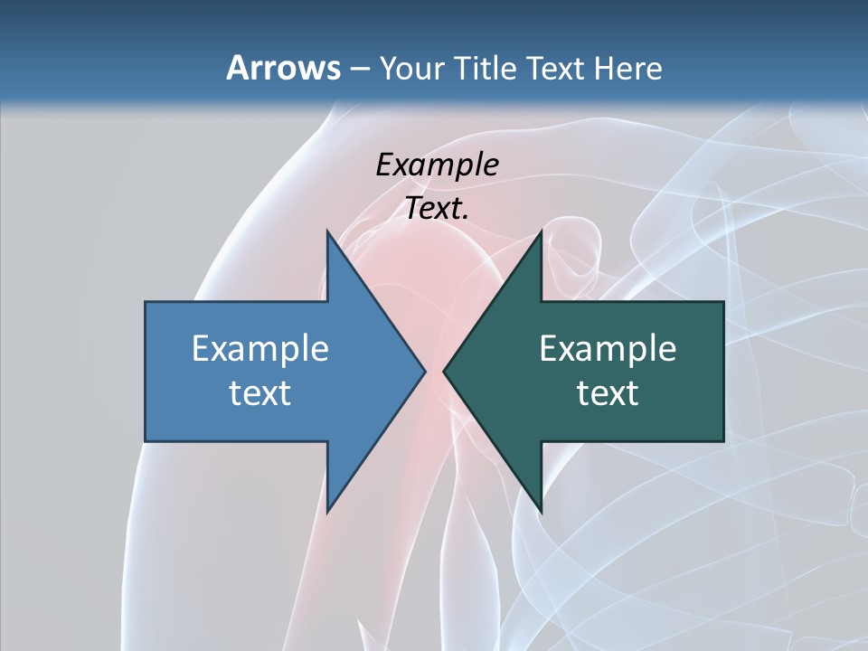 Inflammation Arthritis Pain PowerPoint Template