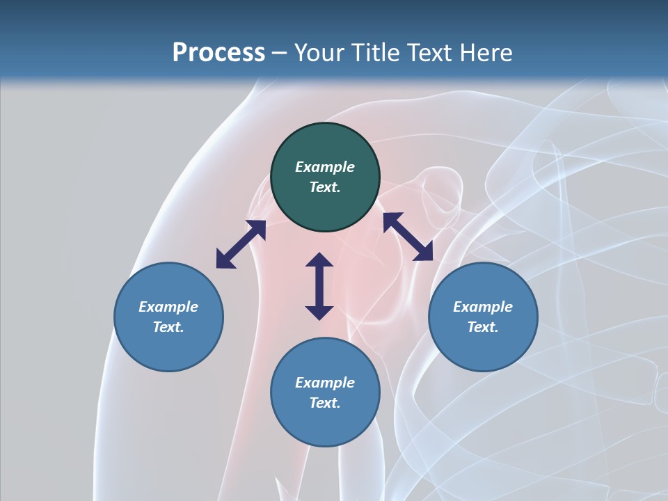 Inflammation Arthritis Pain PowerPoint Template