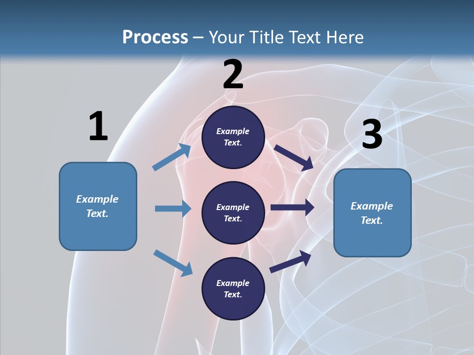 Inflammation Arthritis Pain PowerPoint Template