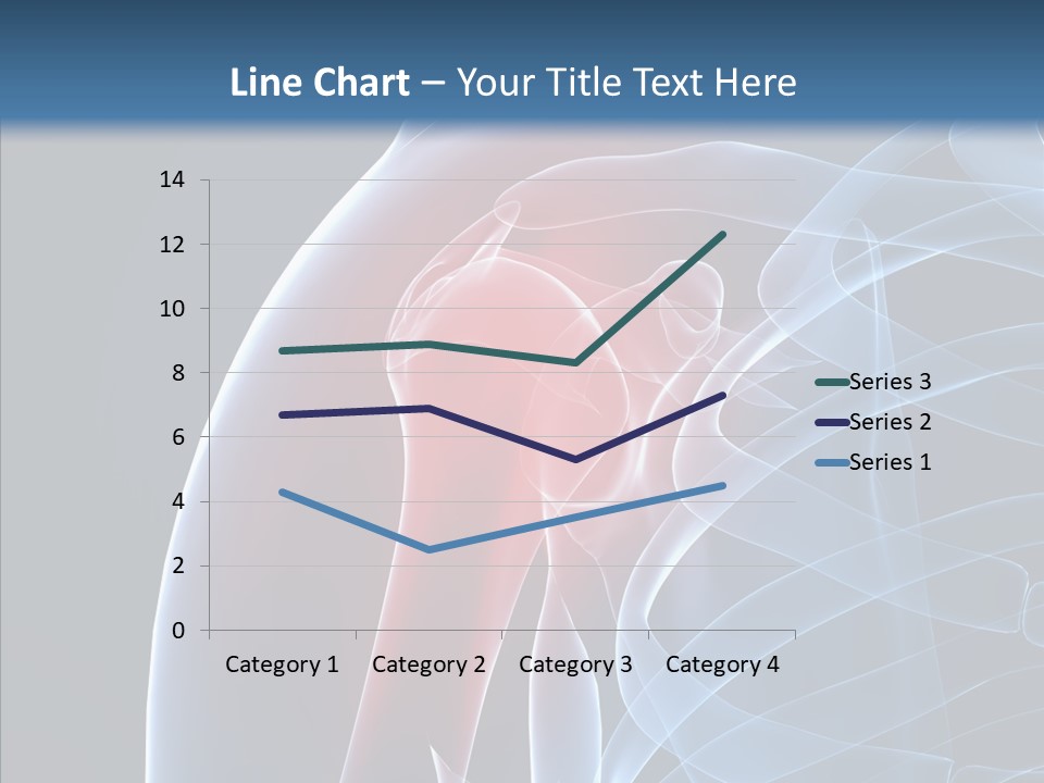 Inflammation Arthritis Pain PowerPoint Template
