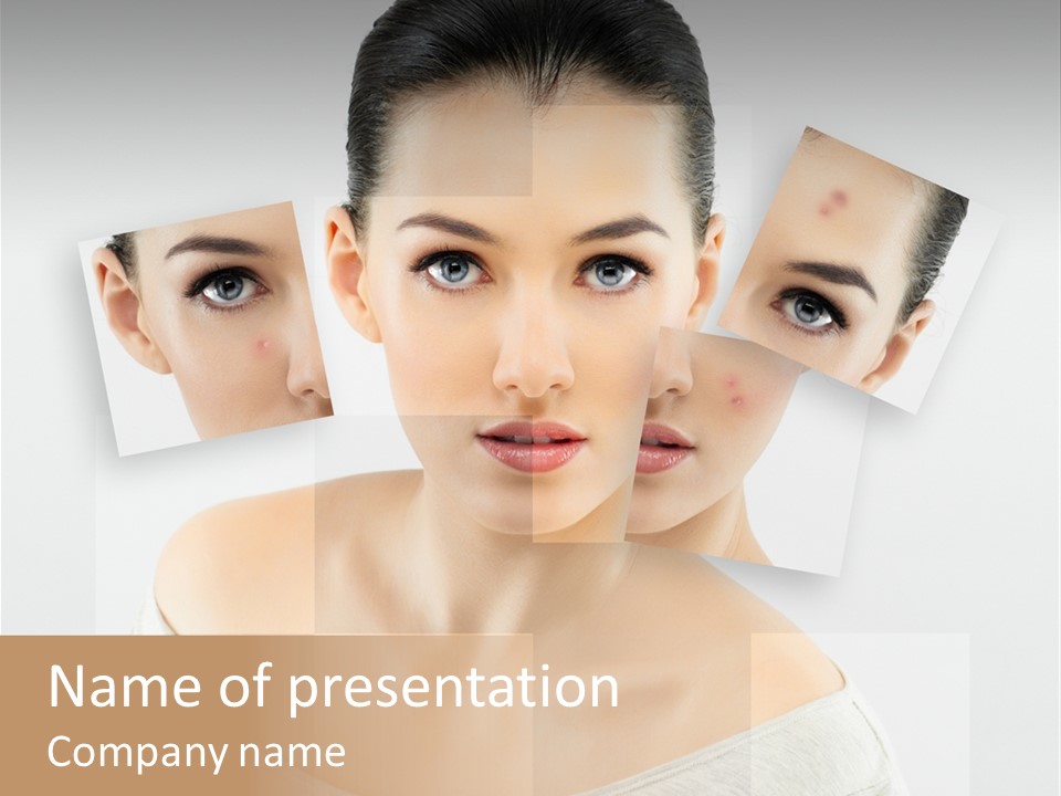 Complexion White Acne PowerPoint Template