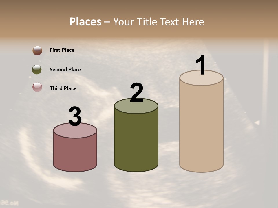 Fetus Ultra Smile PowerPoint Template