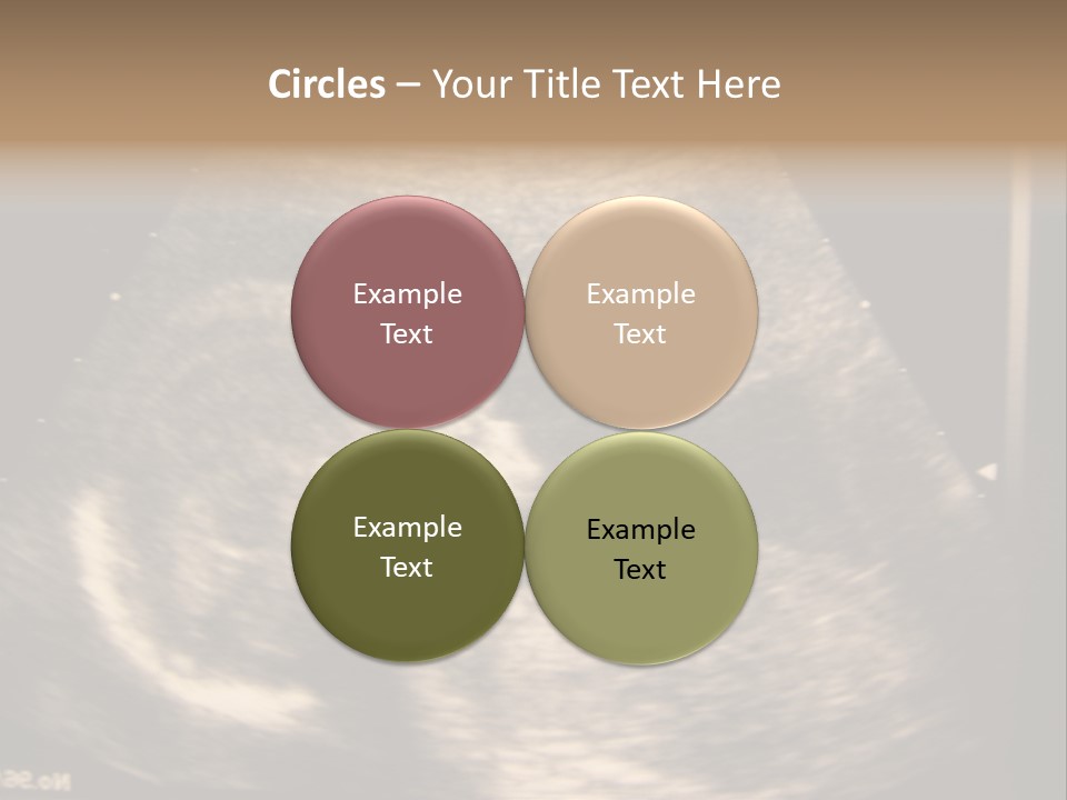 Fetus Ultra Smile PowerPoint Template