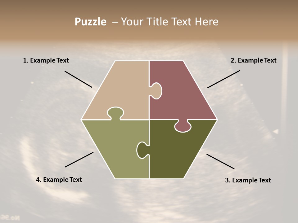 Fetus Ultra Smile PowerPoint Template