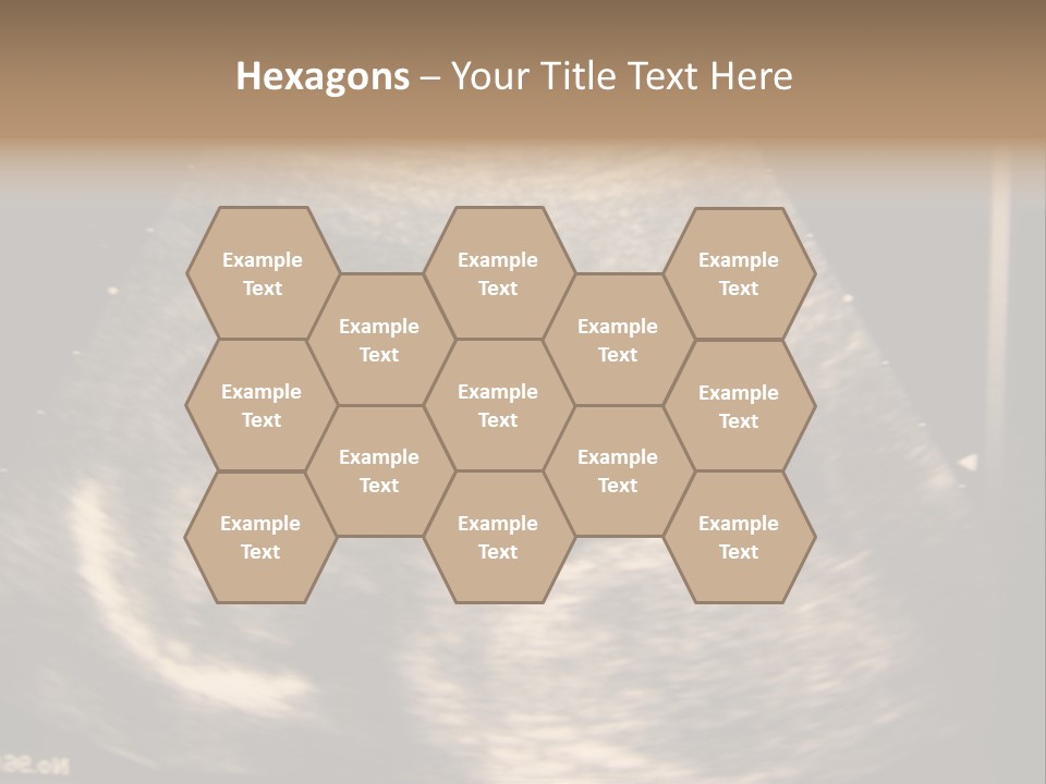 Fetus Ultra Smile PowerPoint Template
