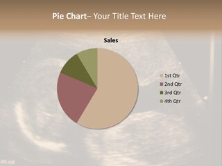 Fetus Ultra Smile PowerPoint Template