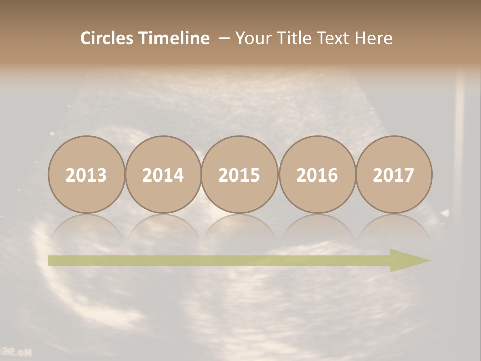 Fetus Ultra Smile PowerPoint Template