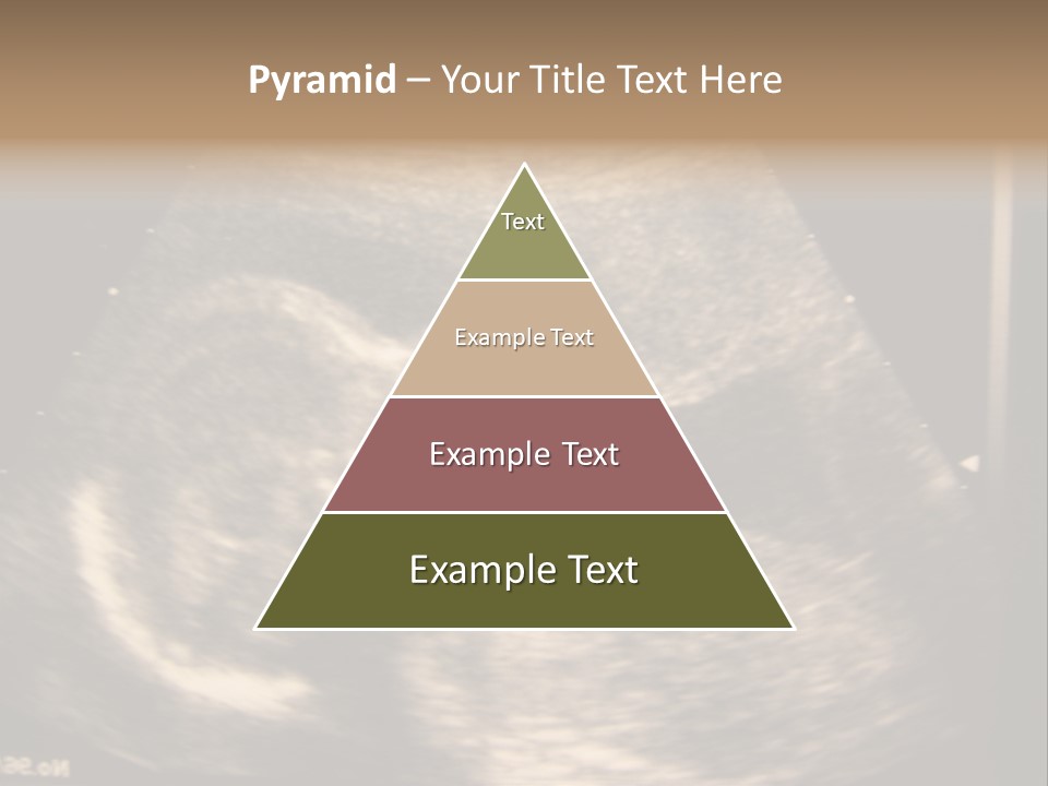 Fetus Ultra Smile PowerPoint Template