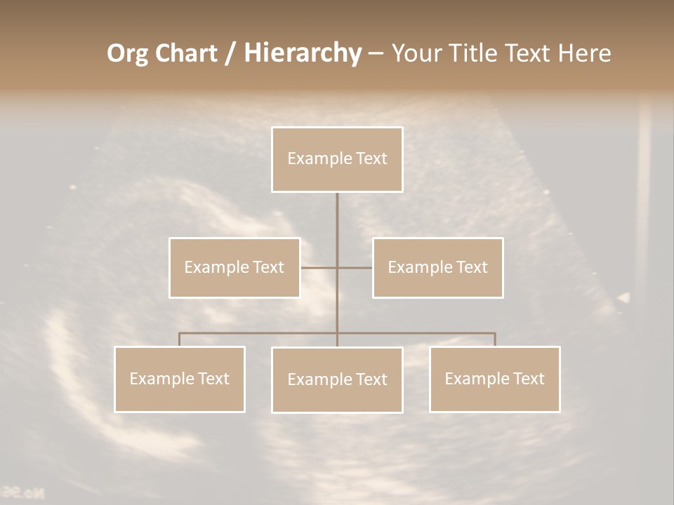 Fetus Ultra Smile PowerPoint Template