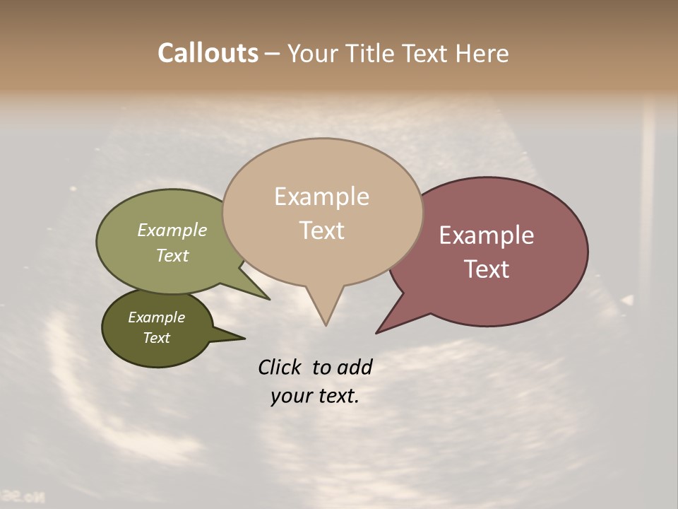 Fetus Ultra Smile PowerPoint Template