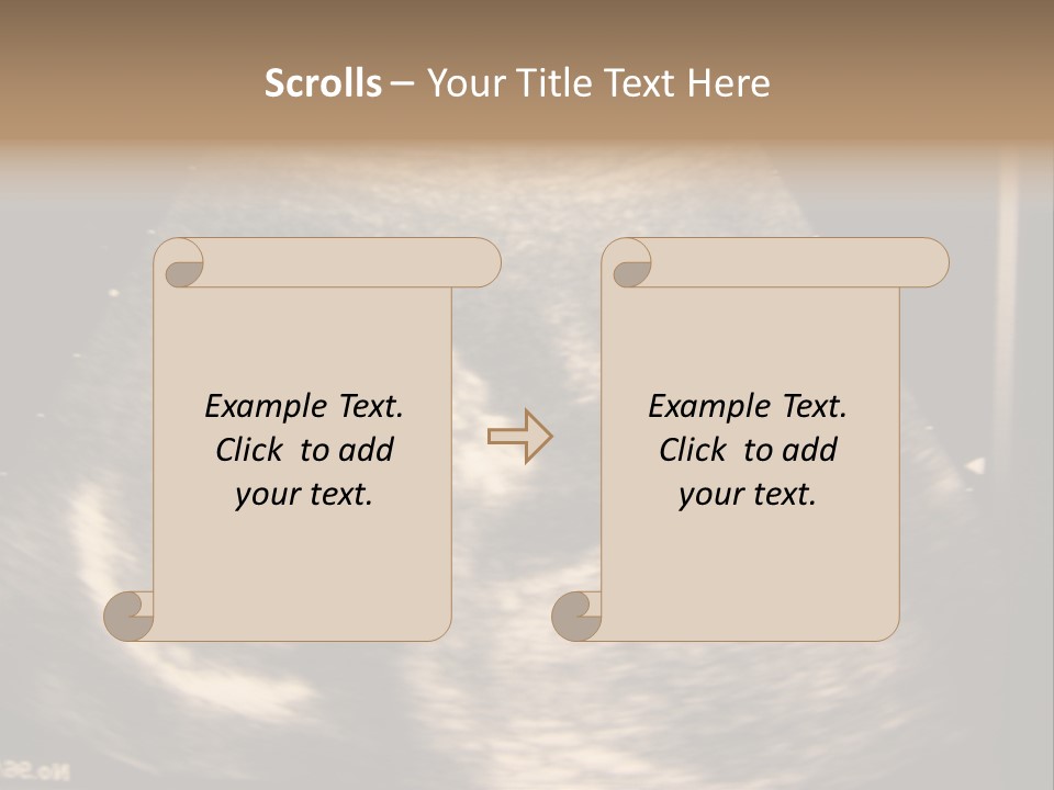 Fetus Ultra Smile PowerPoint Template