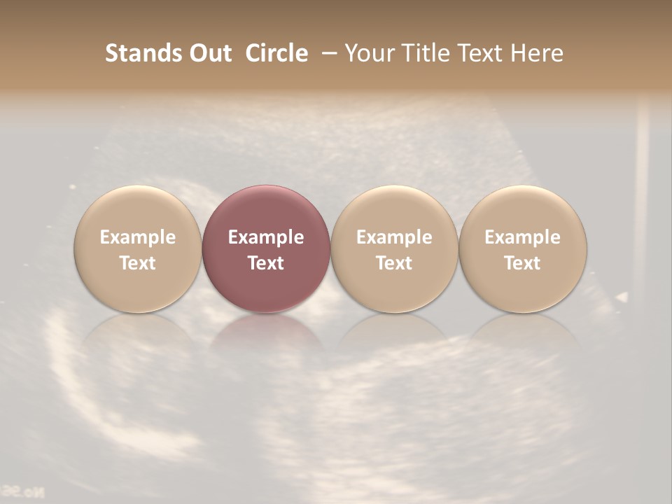 Fetus Ultra Smile PowerPoint Template