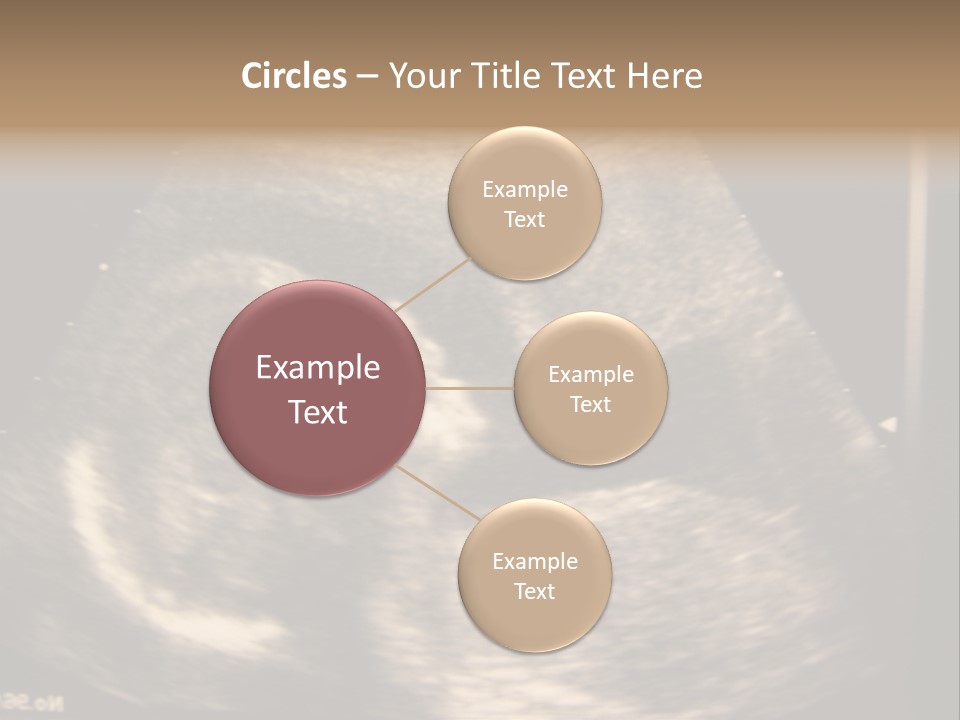 Fetus Ultra Smile PowerPoint Template