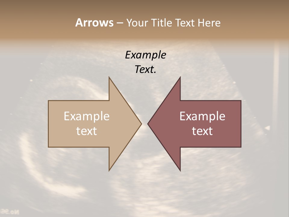 Fetus Ultra Smile PowerPoint Template