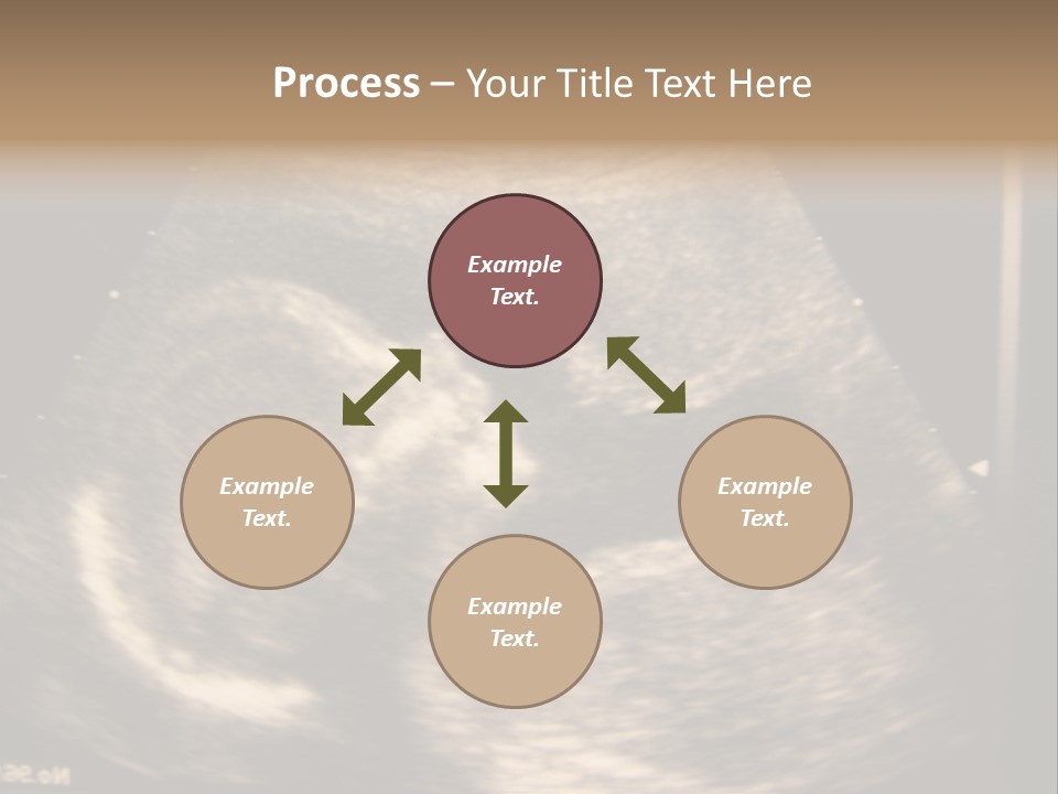 Fetus Ultra Smile PowerPoint Template
