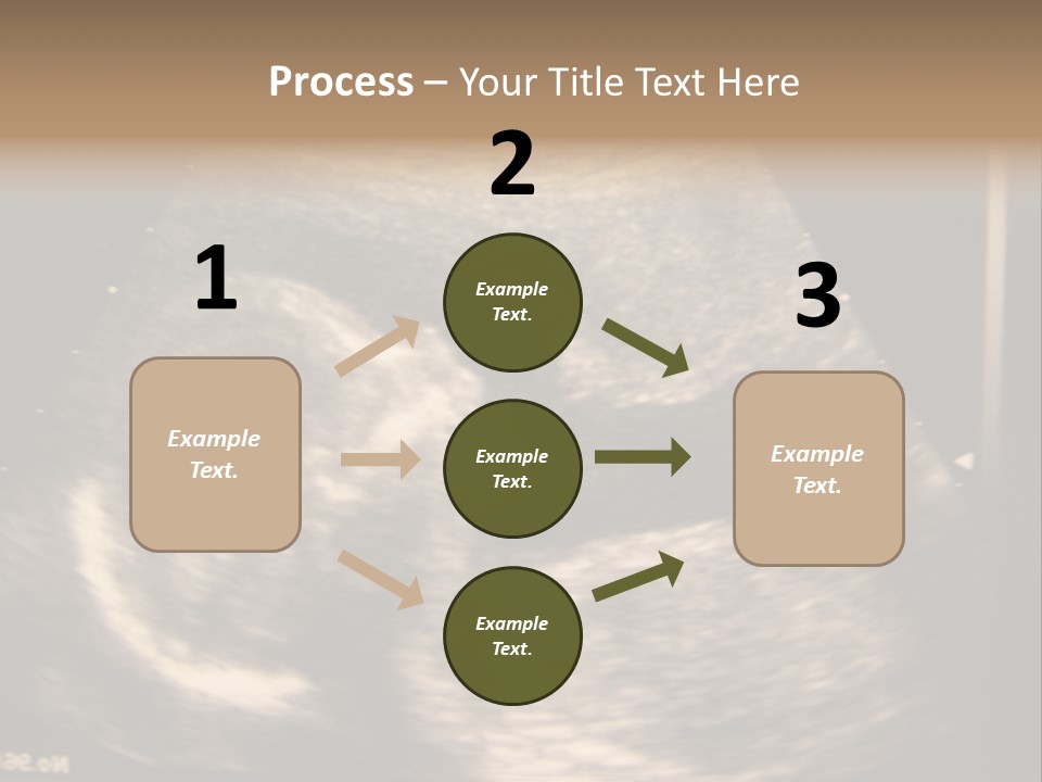 Fetus Ultra Smile PowerPoint Template