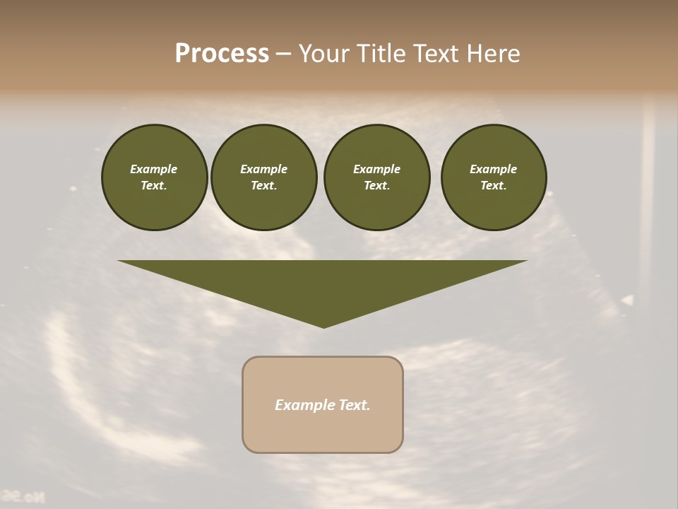 Fetus Ultra Smile PowerPoint Template