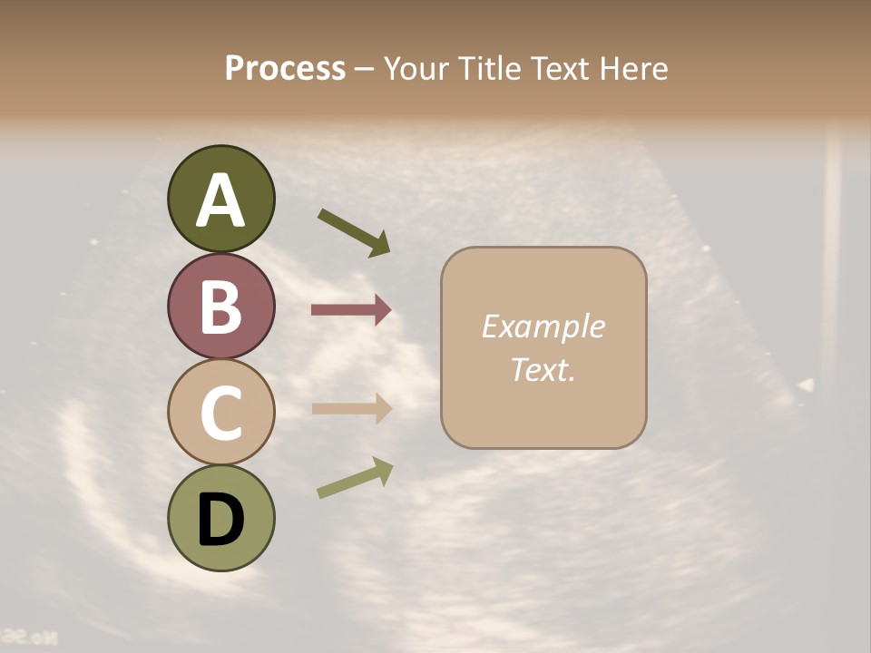 Fetus Ultra Smile PowerPoint Template