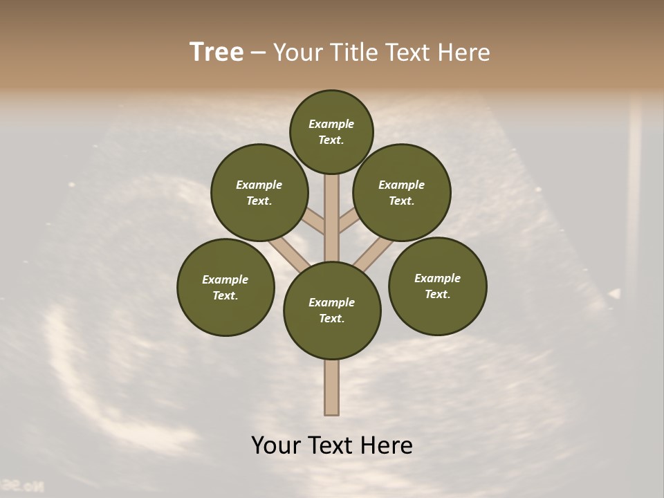 Fetus Ultra Smile PowerPoint Template