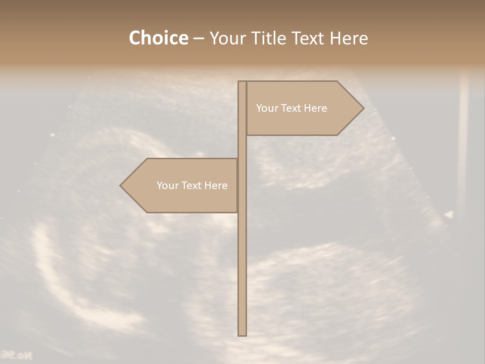 Fetus Ultra Smile PowerPoint Template