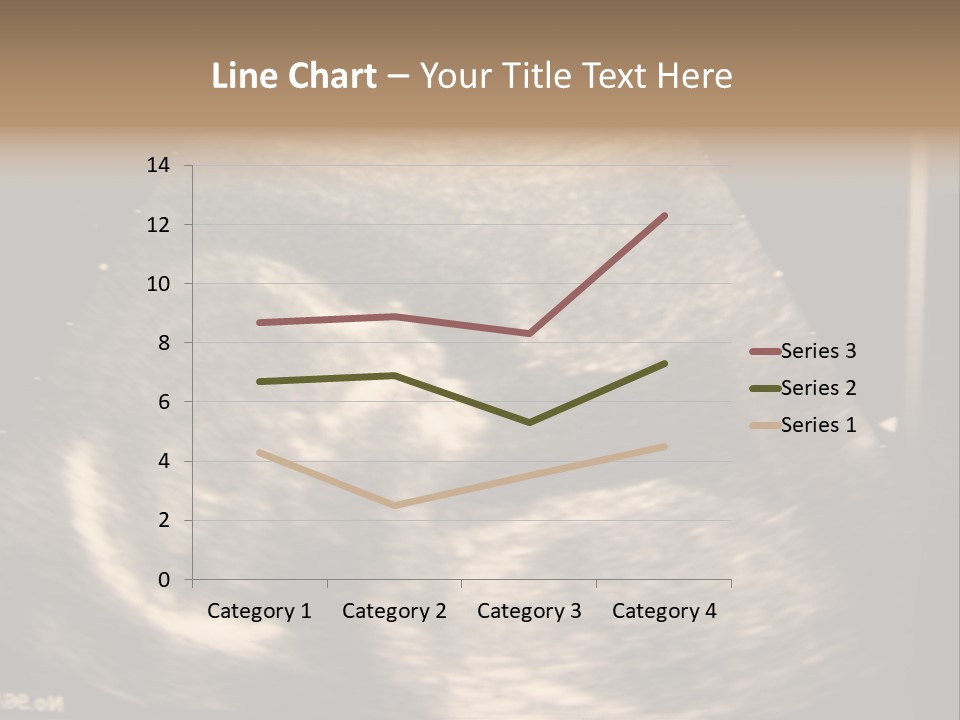 Fetus Ultra Smile PowerPoint Template