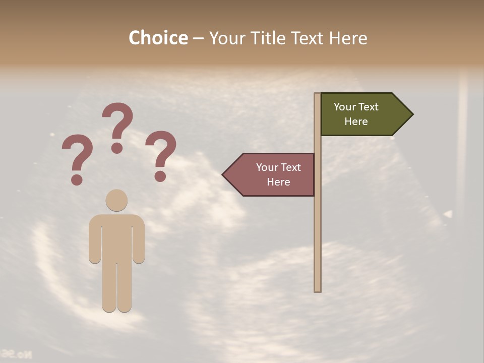 Fetus Ultra Smile PowerPoint Template