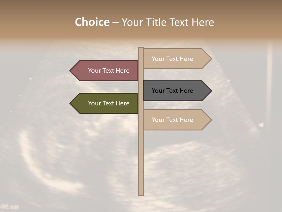 Fetus Ultra Smile PowerPoint Template