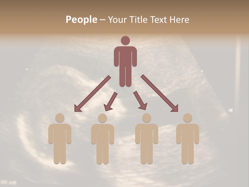 Fetus Ultra Smile PowerPoint Template
