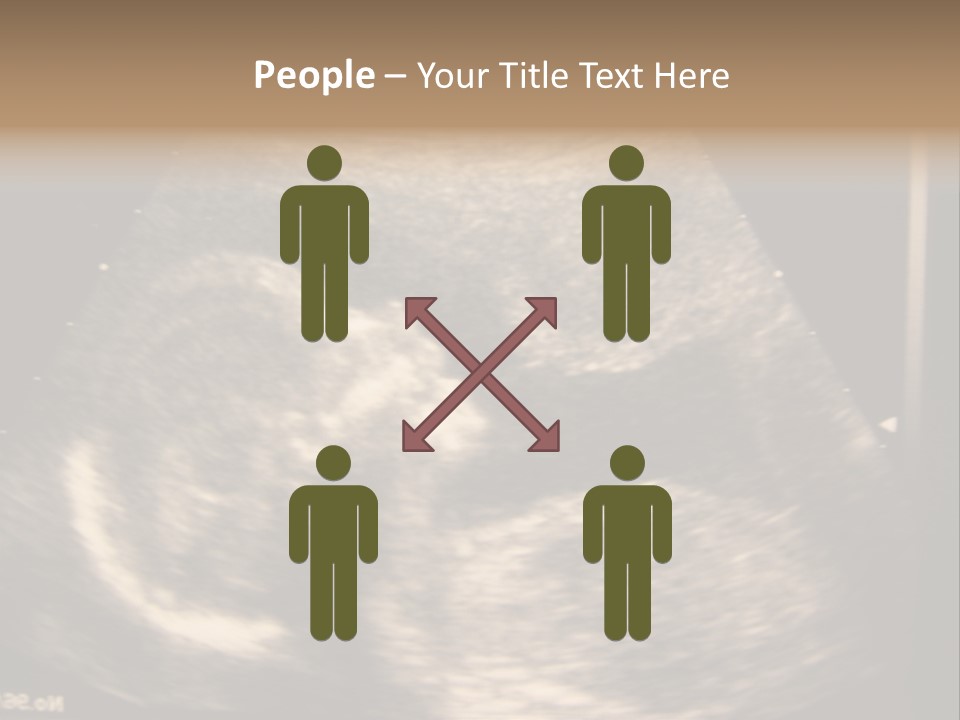 Fetus Ultra Smile PowerPoint Template