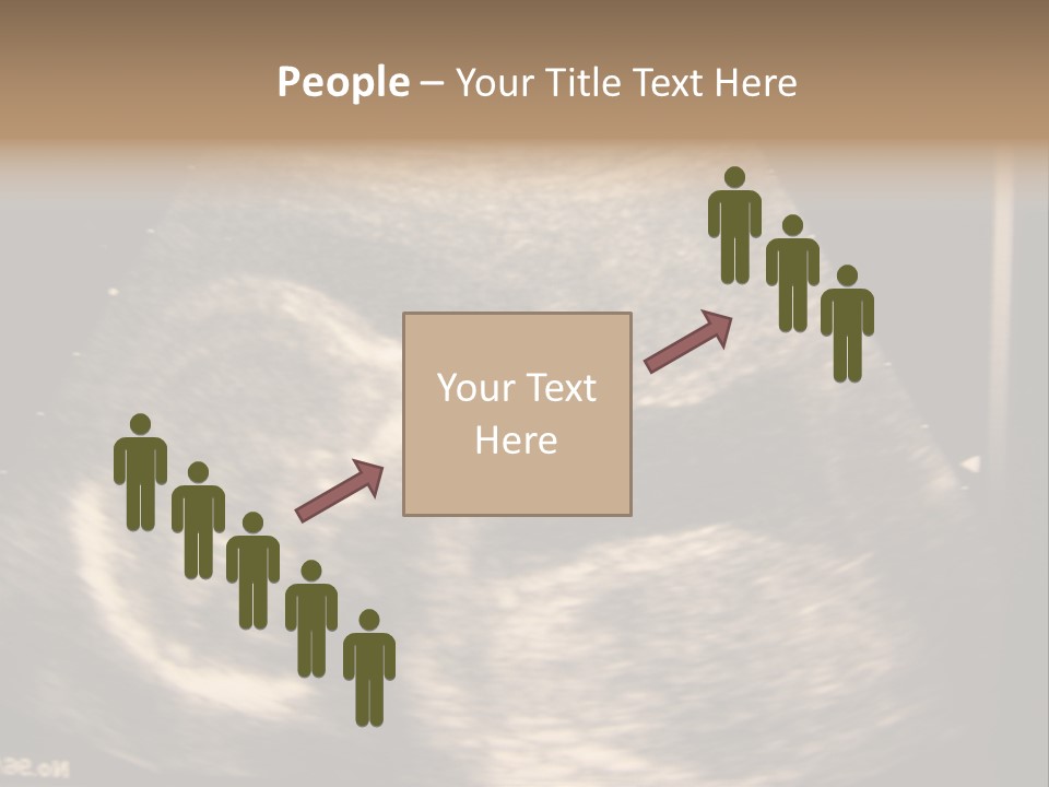 Fetus Ultra Smile PowerPoint Template