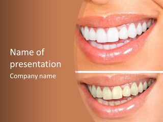 Toothbrush Protection Smile PowerPoint Template