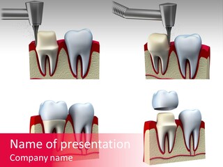 Orthodontic Lab Safeguard PowerPoint Template