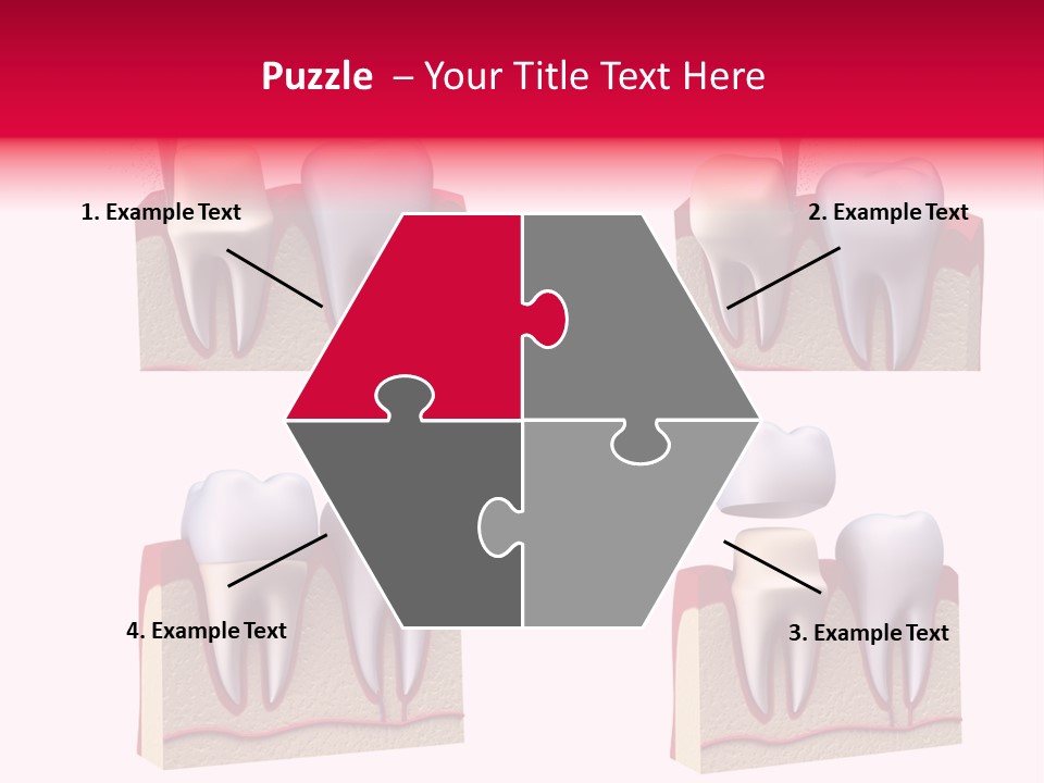 Orthodontic Lab Safeguard PowerPoint Template