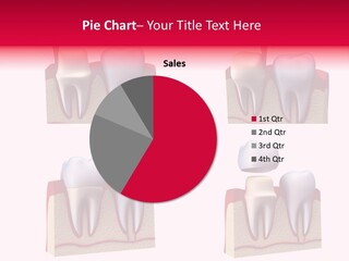 Orthodontic Lab Safeguard PowerPoint Template