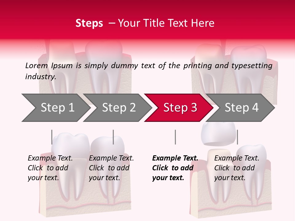 Orthodontic Lab Safeguard PowerPoint Template