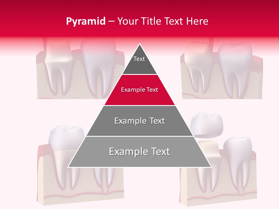Orthodontic Lab Safeguard PowerPoint Template