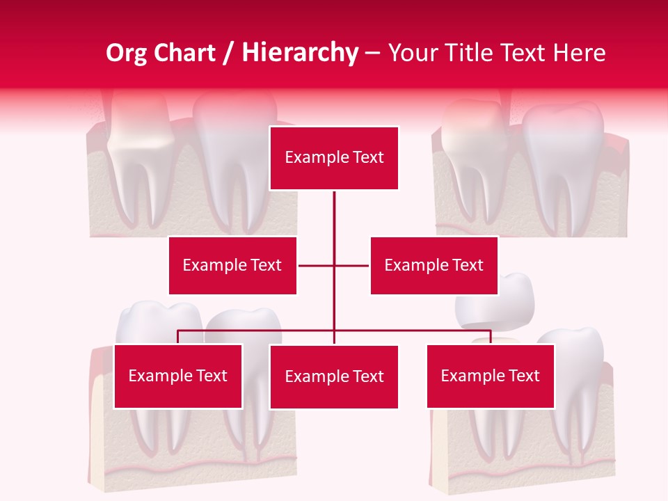 Orthodontic Lab Safeguard PowerPoint Template