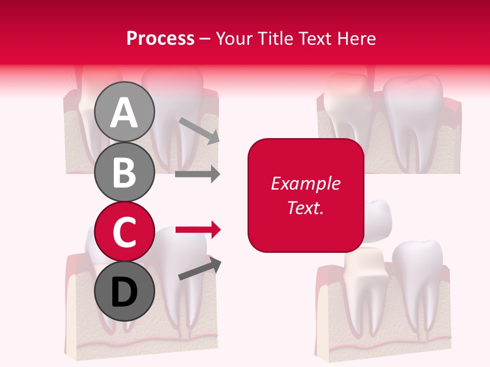 Orthodontic Lab Safeguard PowerPoint Template