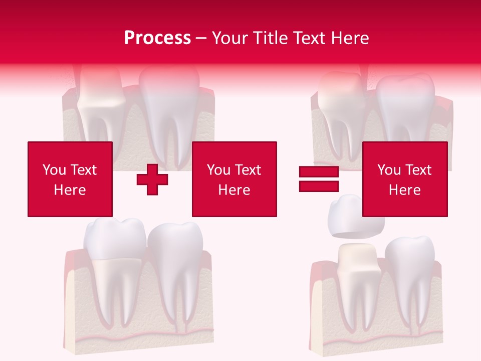 Orthodontic Lab Safeguard PowerPoint Template