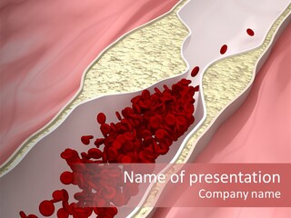 Sphygmomanometer Restenosis Cardiology PowerPoint Template